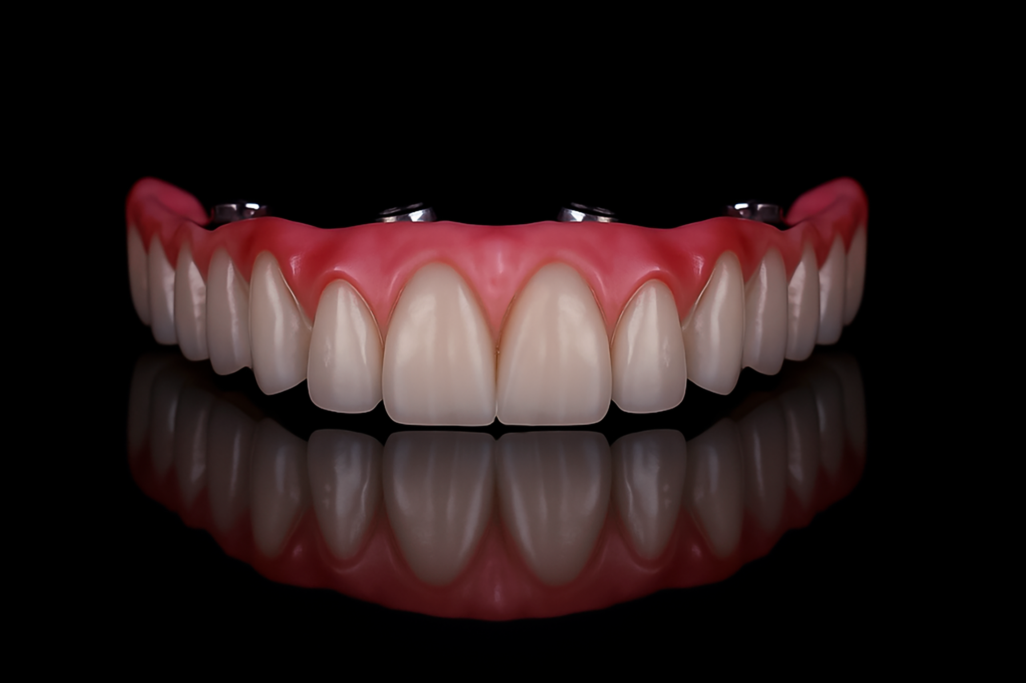 Unisorrir imagem ilustrativa de prótese dentária fixa sobre implantes, com os dentes montados sobre pilares metálicos, em fundo escuro com reflexo